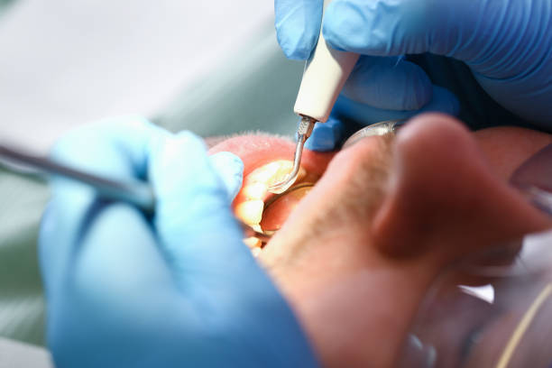 Best Emergency Broken Tooth Repair in Lakeport, CA